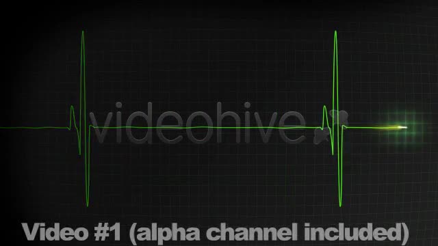 3 EKG Heartbeat Display Monitor Videos - Download Videohive 336291