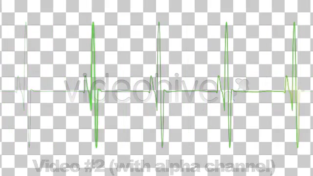 3 EKG Heartbeat Display Monitor Videos - Download Videohive 336291