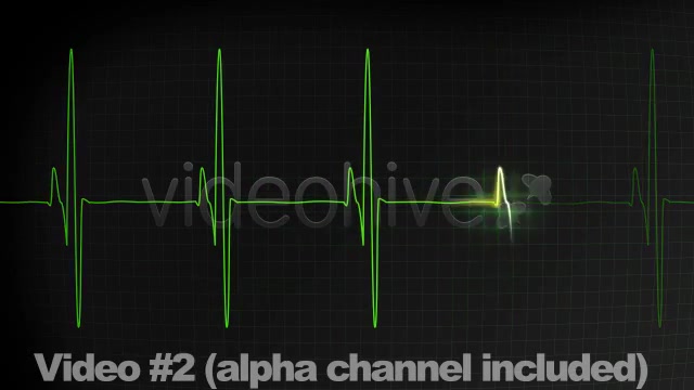 3 EKG Heartbeat Display Monitor Videos - Download Videohive 336291