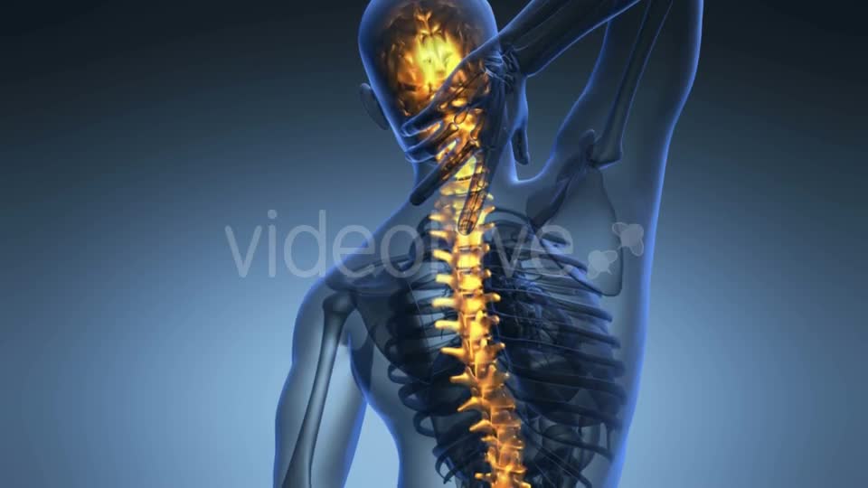 Backache In Back Bones Videohive 18556700 Motion Graphics Image 1