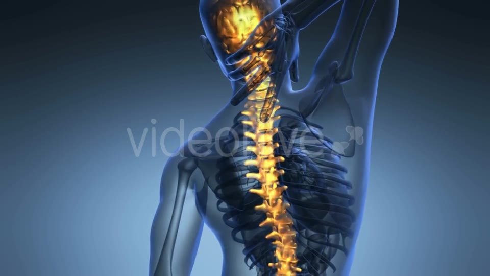 Backache In Back Bones Videohive 18556700 Motion Graphics Image 2