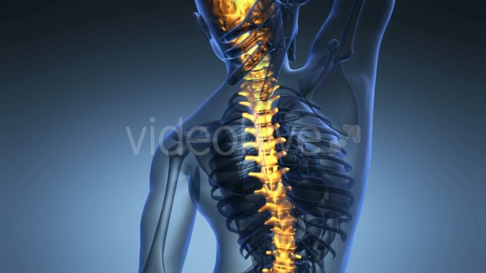 Backache In Back Bones Videohive 18556700 Motion Graphics Image 3