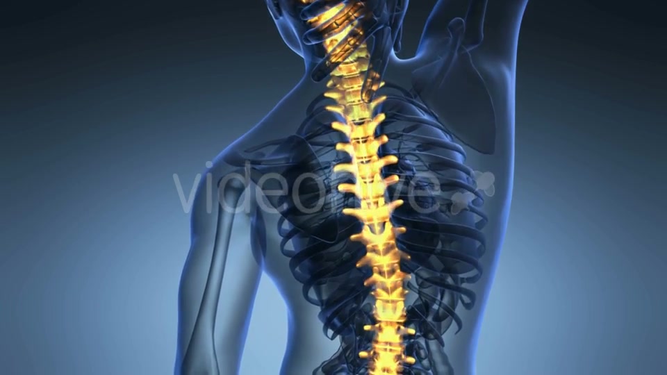 Backache In Back Bones Videohive 18556700 Motion Graphics Image 4