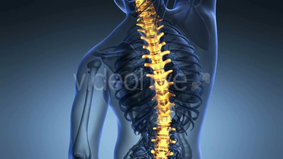 Backache In Back Bones Videohive 18556700 Motion Graphics Image 5