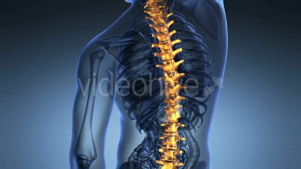 Backache In Back Bones Videohive 18556700 Motion Graphics Image 6