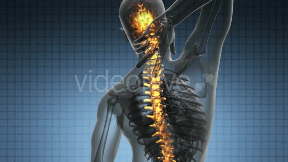 Backache In Back Bones - Download Videohive 18444490
