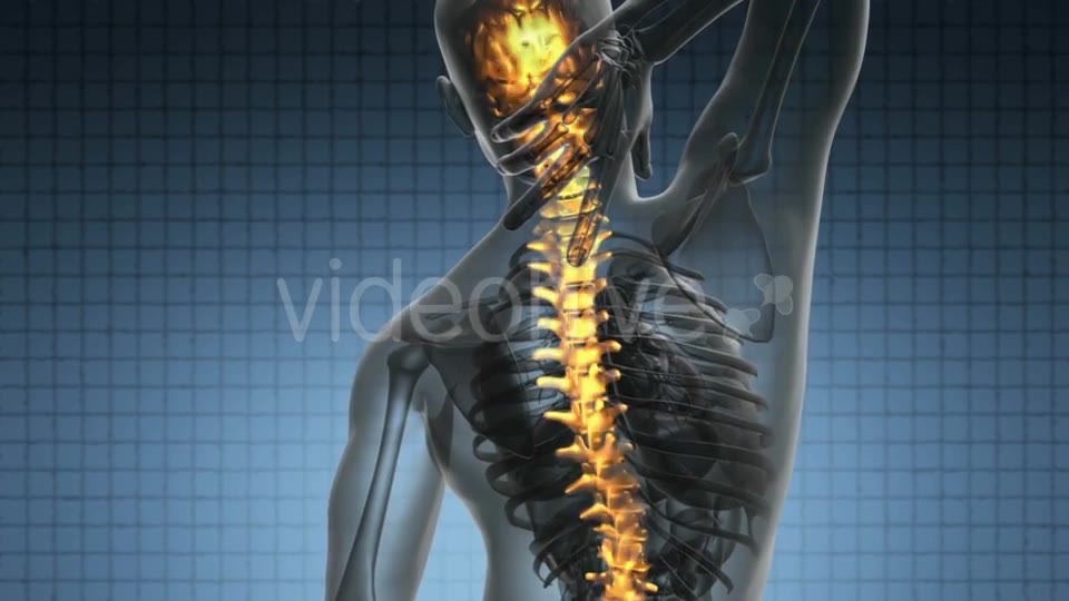 Backache In Back Bones - Download Videohive 18444490