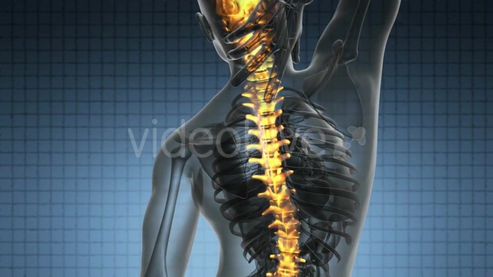 Backache In Back Bones - Download Videohive 18444490