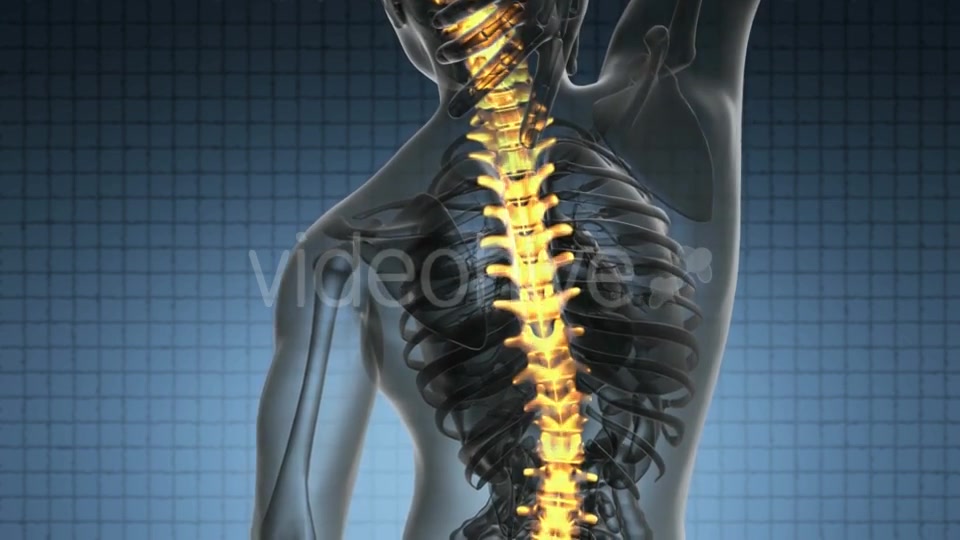 Backache In Back Bones - Download Videohive 18444490