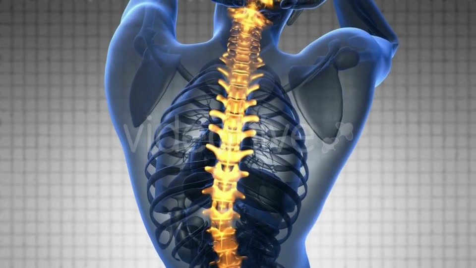 Backache In Back Bones - Download Videohive 18481569