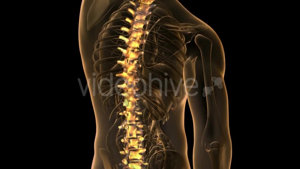 Backache In Back Bones - Download Videohive 18481675