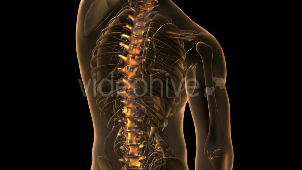 Backache In Back Bones - Download Videohive 18481675