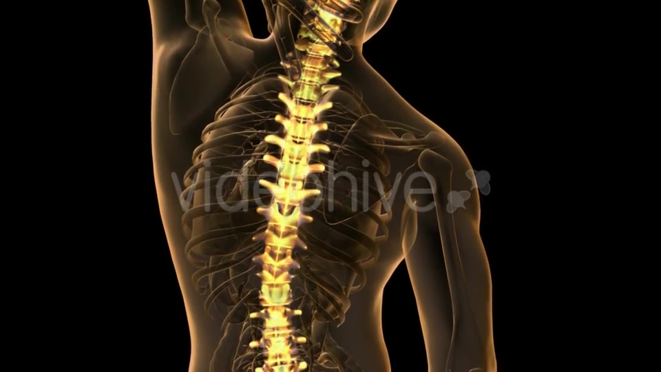 Backache In Back Bones - Download Videohive 18481675