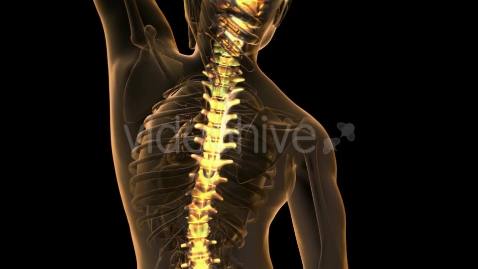 Backache In Back Bones - Download Videohive 18481675