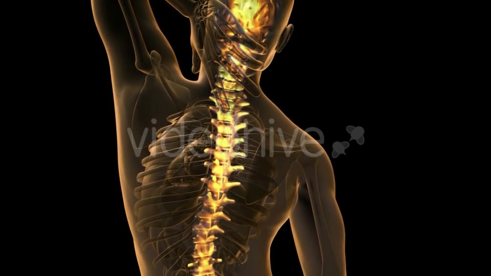 Backache In Back Bones - Download Videohive 18481675