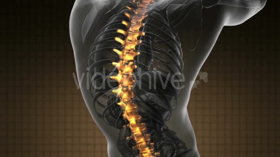 Backache In Back Bones - Download Videohive 18556685