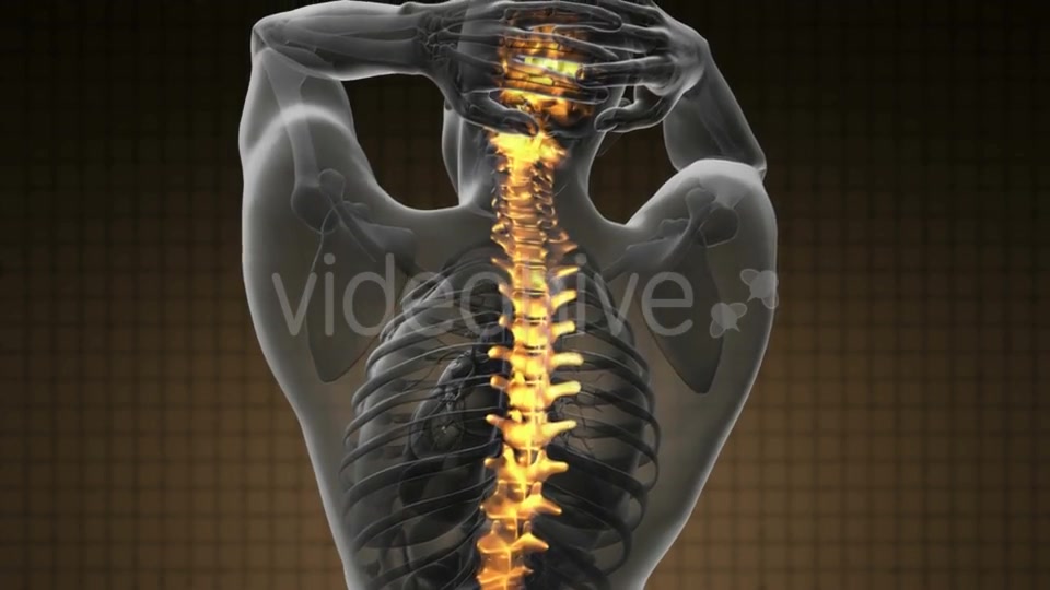 Backache In Back Bones - Download Videohive 18556685