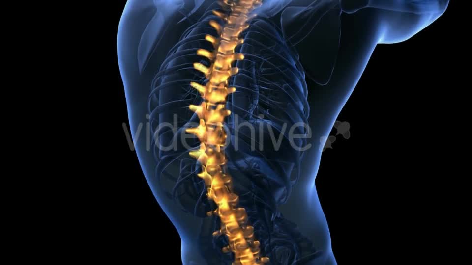 Backache in Back Bones - Download Videohive 18967055