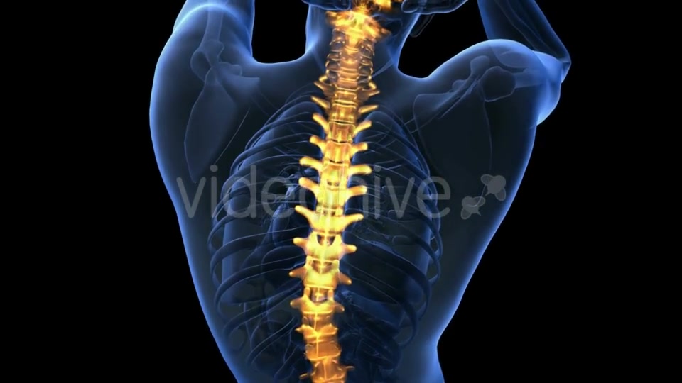 Backache in Back Bones - Download Videohive 18967055