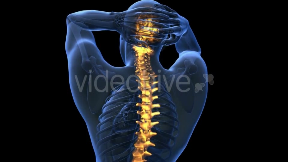 Backache in Back Bones - Download Videohive 18967055