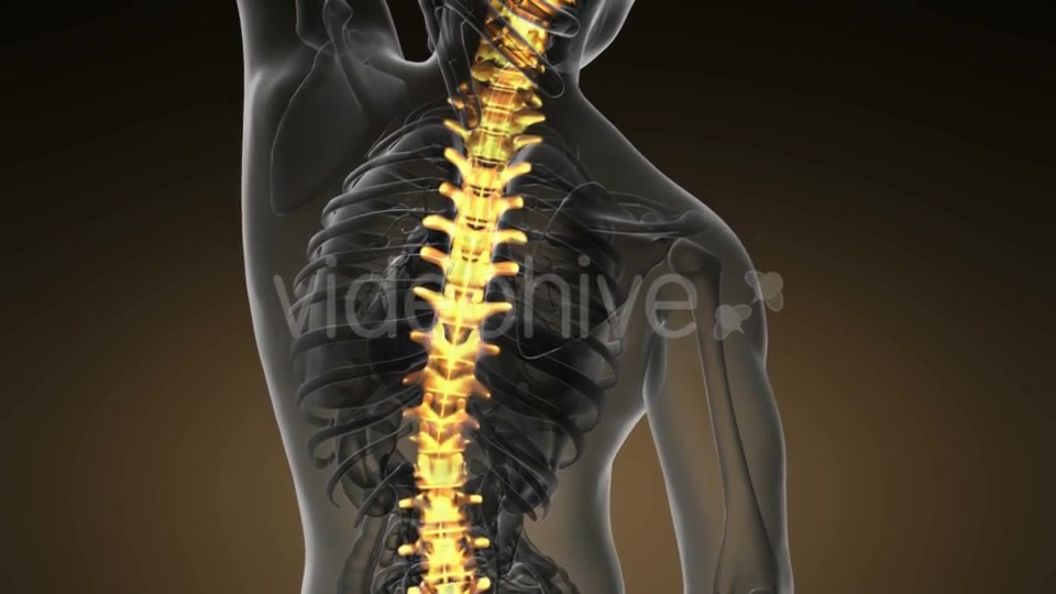 Backache in Back Bones - Download Videohive 18967064