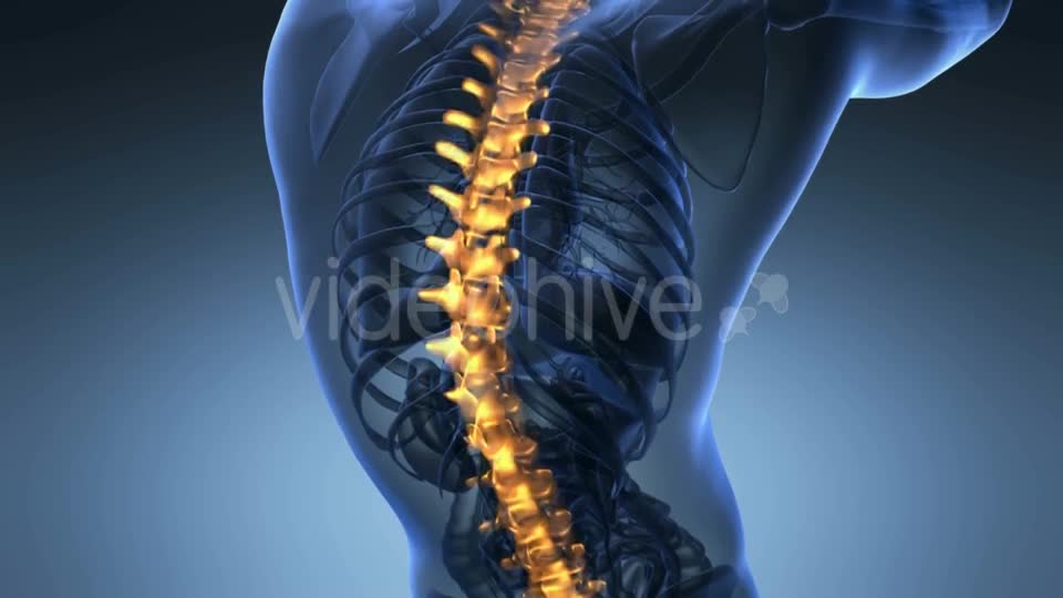 Backache in Back Bones - Download Videohive 19011771