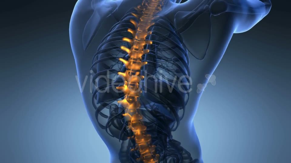 Backache in Back Bones - Download Videohive 19011771