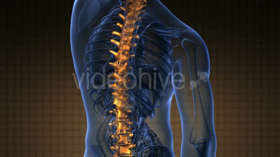 Backache in Back Bones - Download Videohive 19290041