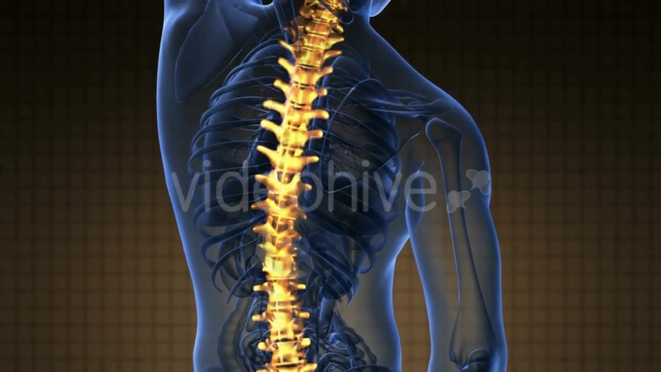 Backache in Back Bones - Download Videohive 19290041