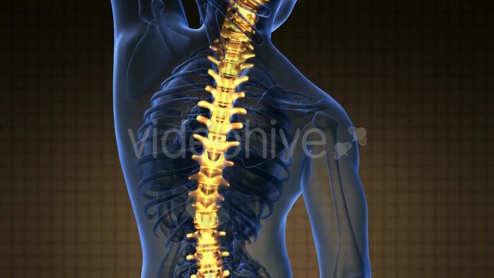 Backache in Back Bones - Download Videohive 19290041