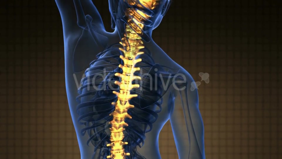 Backache in Back Bones - Download Videohive 19290041