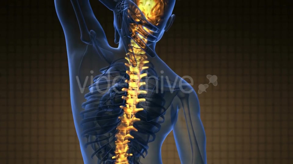 Backache in Back Bones - Download Videohive 19290041