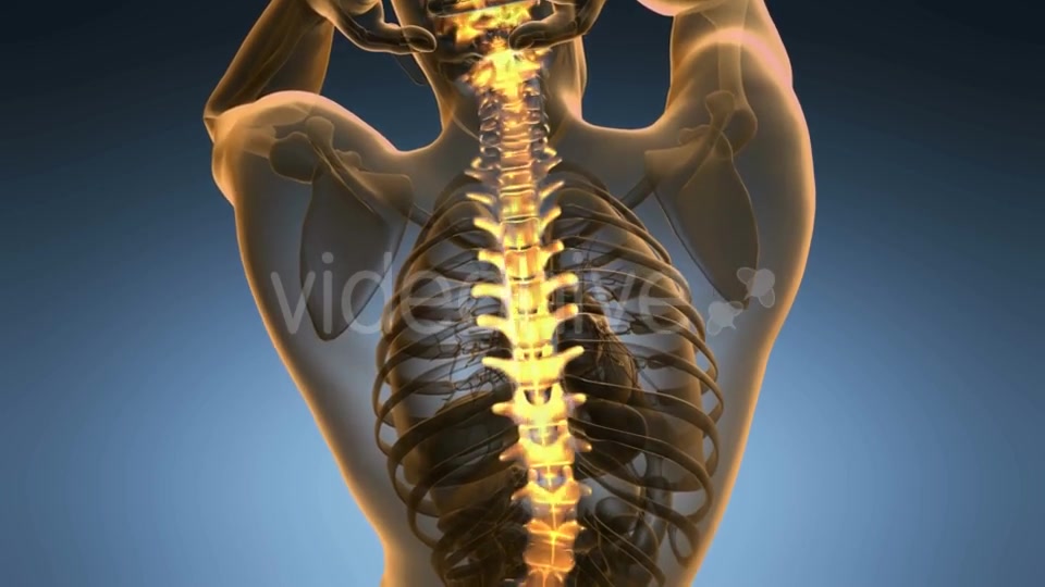 Backache in Back Bones - Download Videohive 19893444