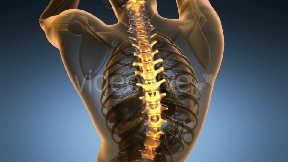 Backache in Back Bones - Download Videohive 19893444