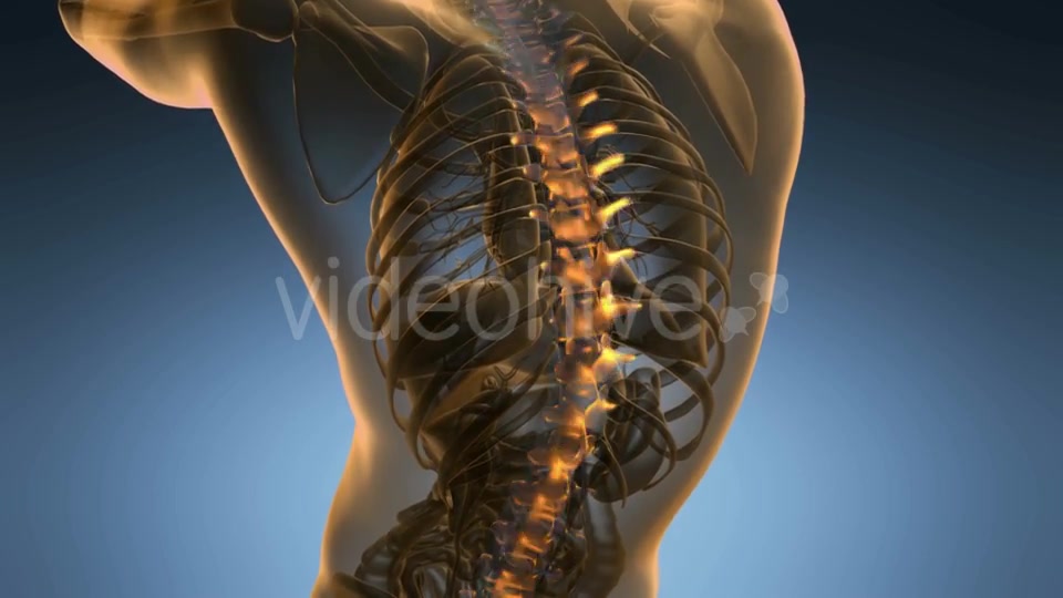 Backache in Back Bones - Download Videohive 19893444