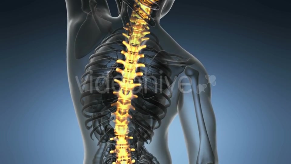 Backache in Back Bones - Download Videohive 19893449