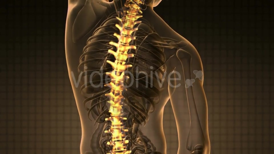 Backache in Back Bones - Download Videohive 19893467