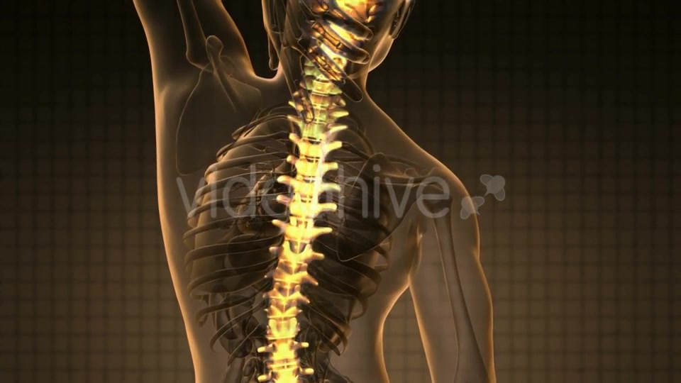 Backache in Back Bones - Download Videohive 19893467