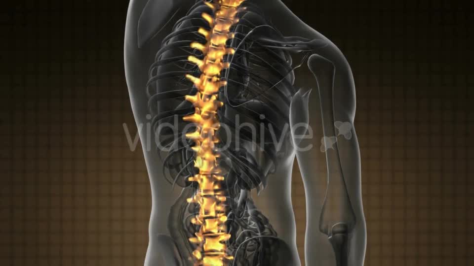 Backache in Back Bones - Download Videohive 19928075