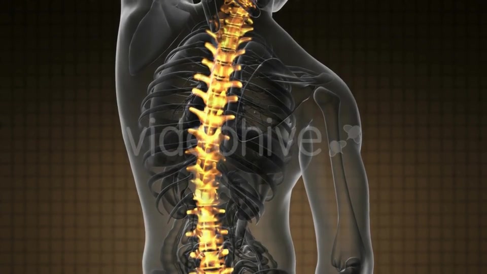 Backache in Back Bones - Download Videohive 19928075