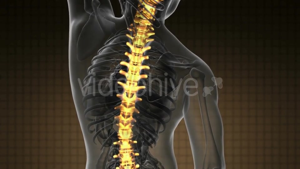 Backache in Back Bones - Download Videohive 19928075