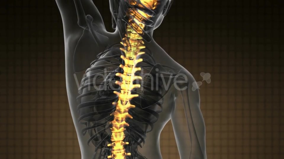 Backache in Back Bones - Download Videohive 19928075