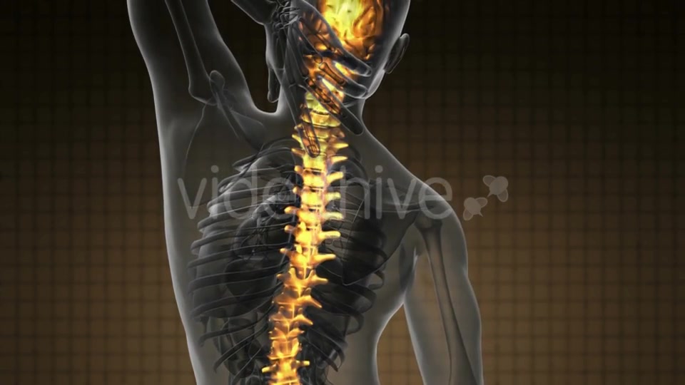 Backache in Back Bones - Download Videohive 19928075