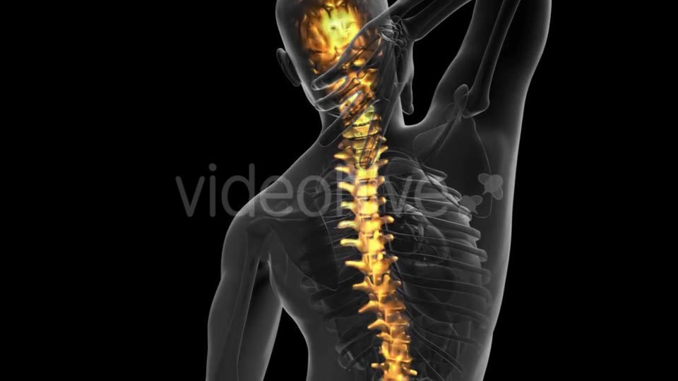 Backache in Back Bones - Download Videohive 19989702