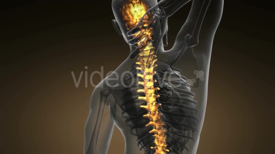 Backache in Back Bones - Download Videohive 20011116