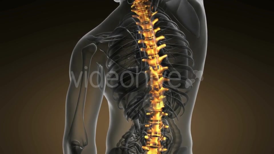 Backache in Back Bones - Download Videohive 20011116