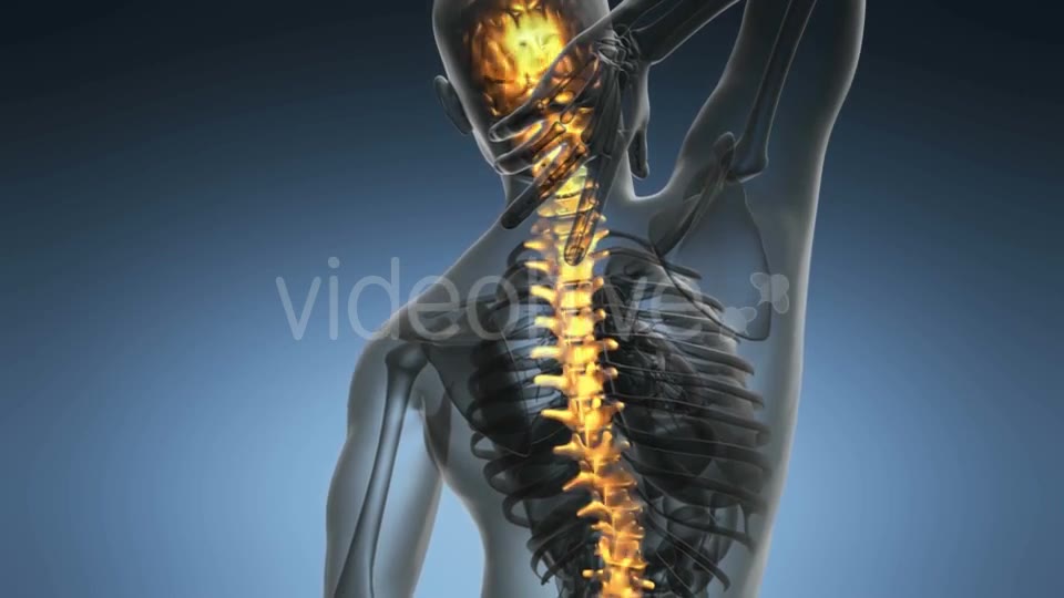 Backache in Back Bones - Download Videohive 20117497