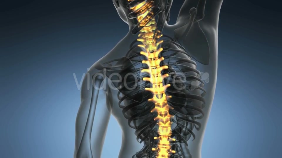 Backache in Back Bones - Download Videohive 20117497