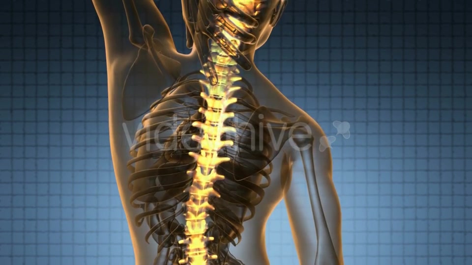 Backache in Back Bones - Download Videohive 20290829