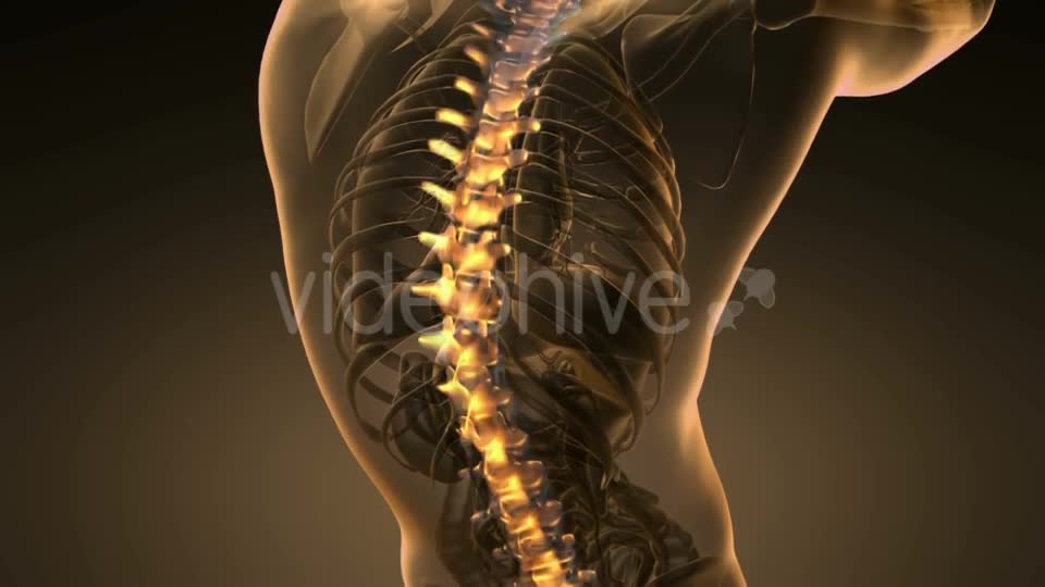 Backache in Back Bones - Download Videohive 20567311